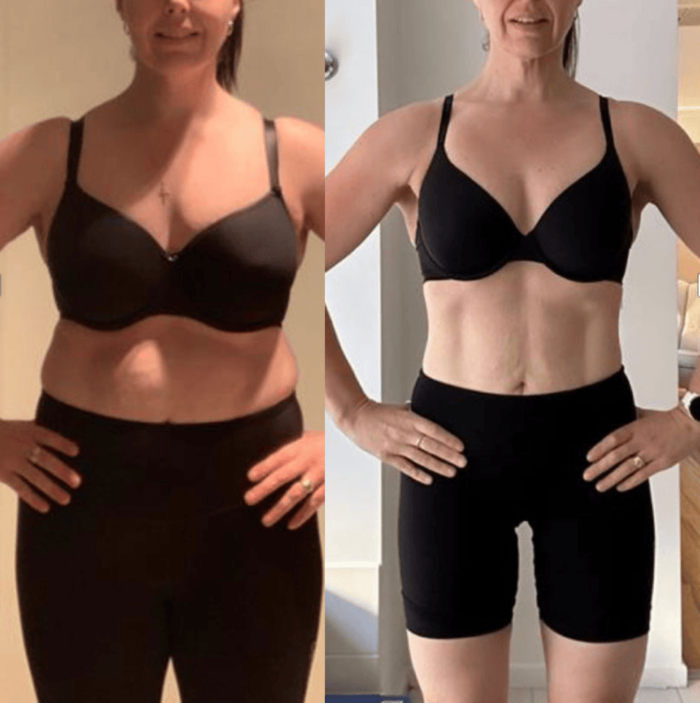 STOMACH before and after, before on the left