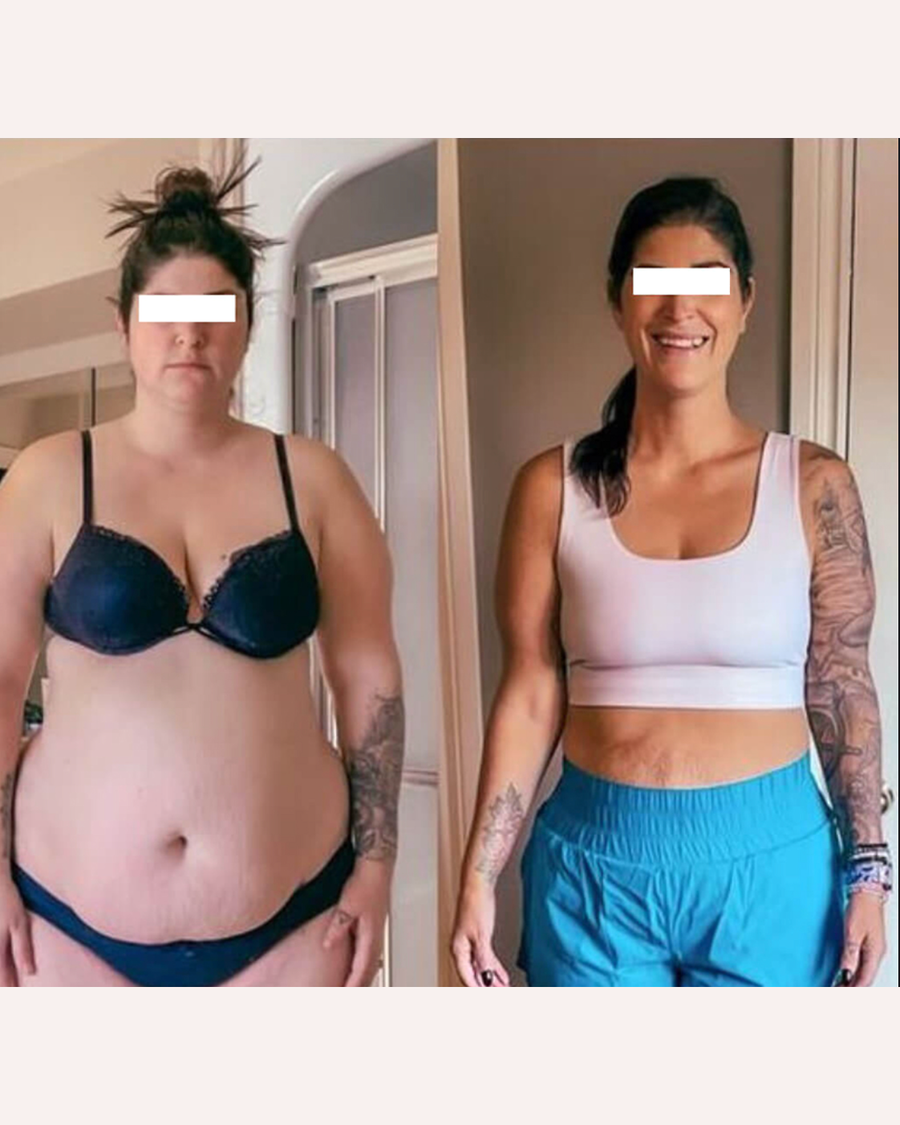 Customer front-view progress comparison; individual results vary