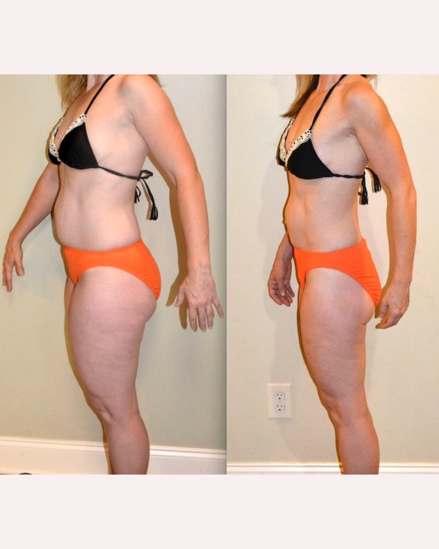 Customer side-profile progress comparison; individual results vary