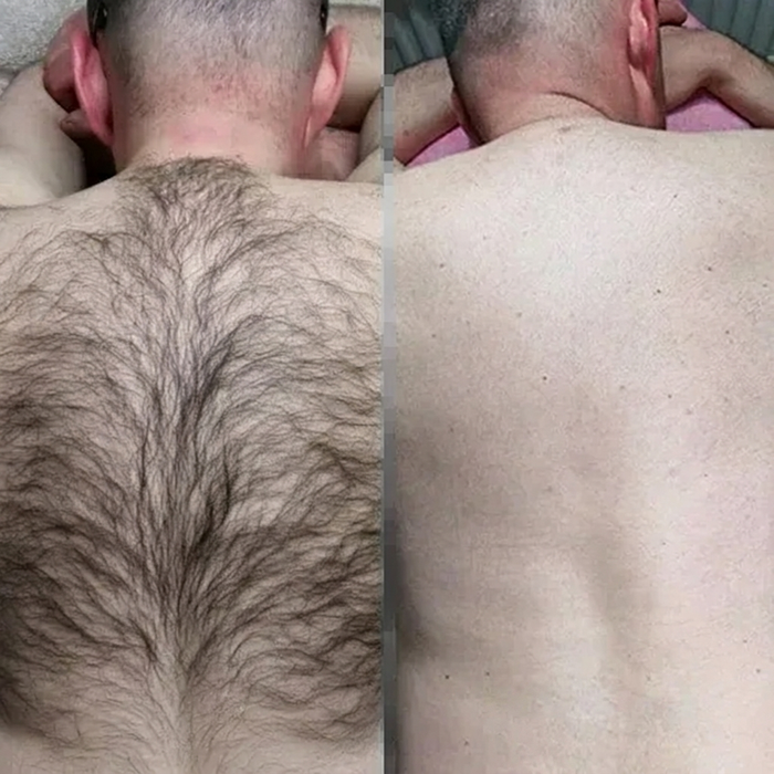 Back hair before and after